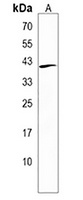 VASH2 Rabbit Polyclonal Antibody
