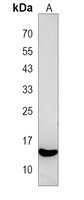 PIK3IP1 Rabbit Polyclonal Antibody