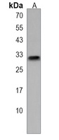 APOBEC1 Rabbit Polyclonal Antibody