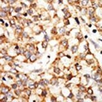 APOBEC1 Rabbit Polyclonal Antibody