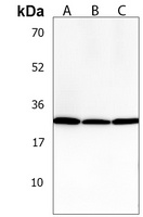 PGAM4 Rabbit Polyclonal Antibody
