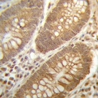 PGAM4 Rabbit Polyclonal Antibody