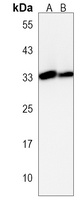 PI15 Rabbit Polyclonal Antibody