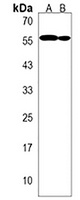 TRIM64 Rabbit Polyclonal Antibody