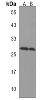 CCDC134 Rabbit Polyclonal Antibody
