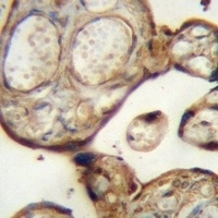 SGPP1 Rabbit Polyclonal Antibody