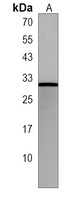 MRAP2 Antibody