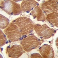 CLMP Antibody