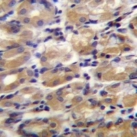 TOR1B Rabbit Polyclonal Antibody
