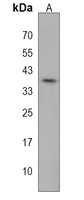 MUC15 Rabbit Polyclonal Antibody