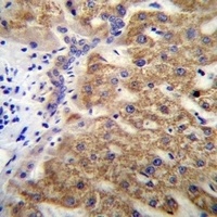 MUC15 Rabbit Polyclonal Antibody