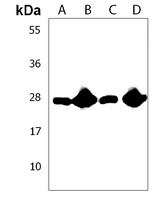 RAB11B Rabbit Polyclonal Antibody