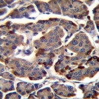 RAB11B Rabbit Polyclonal Antibody