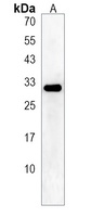 CD353 Rabbit Polyclonal Antibody
