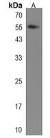 SCHIP1 Rabbit Polyclonal Antibody