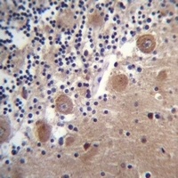 SCHIP1 Rabbit Polyclonal Antibody