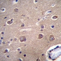 NCX3 Rabbit Polyclonal Antibody