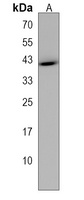 TRUB1 Rabbit Polyclonal Antibody