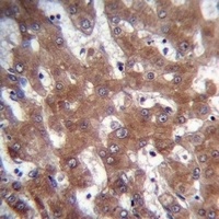 TRUB1 Rabbit Polyclonal Antibody