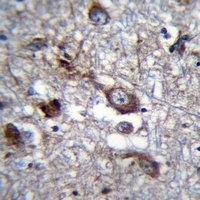 PLEKHH1 Rabbit Polyclonal Antibody