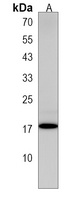 CNRIP1 Rabbit Polyclonal Antibody