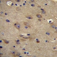 CNRIP1 Rabbit Polyclonal Antibody