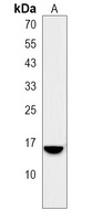 SPINK8 Rabbit Polyclonal Antibody