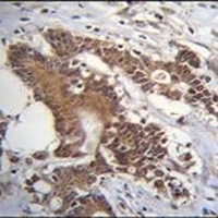 CCT alpha Rabbit Polyclonal Antibody