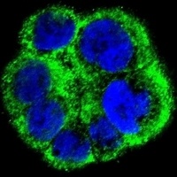 CCT alpha Rabbit Polyclonal Antibody