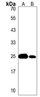 SDHD Rabbit Polyclonal Antibody