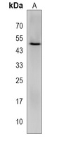 SAMD8 Rabbit Polyclonal Antibody