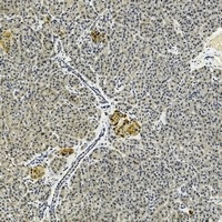 IL-17B Antibody