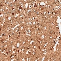 TUBB2B Rabbit Polyclonal Antibody