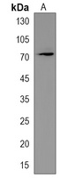 DCAF8L2 Rabbit Polyclonal Antibody