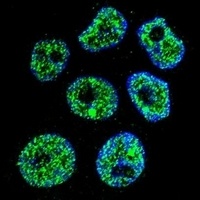 DCAF8L2 Rabbit Polyclonal Antibody