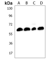 Collagen 8 alpha 2 Rabbit Polyclonal Antibody