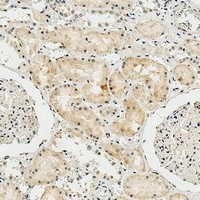 Collagen 8 alpha 2 Rabbit Polyclonal Antibody