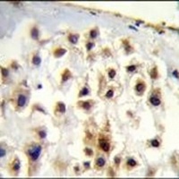 Collagen 13 alpha 1 Rabbit Polyclonal Antibody