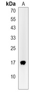 LSM7 Rabbit Polyclonal Antibody