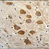 HCFC1R1 Rabbit Polyclonal Antibody