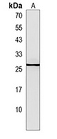 p23 Rabbit Polyclonal Antibody