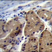 DCDC5 Rabbit Polyclonal Antibody