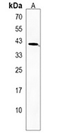 Siglec 15 Rabbit Polyclonal Antibody