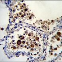 Siglec 15 Rabbit Polyclonal Antibody
