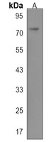 CPT1C Rabbit Polyclonal Antibody