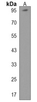 PTCHD3 Rabbit Polyclonal Antibody