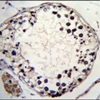 PTCHD3 Rabbit Polyclonal Antibody