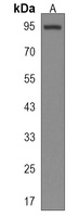 PTCHD4 Rabbit Polyclonal Antibody