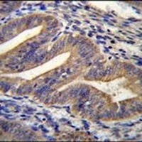 METTL10 Rabbit Polyclonal Antibody