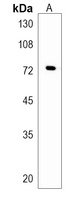FBXO21 Rabbit Polyclonal Antibody